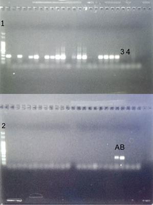 First report of Mansonella sp. and Dipetalonema gracile in the Amazonian city-dwelling threatened primate, Saguinus bicolor